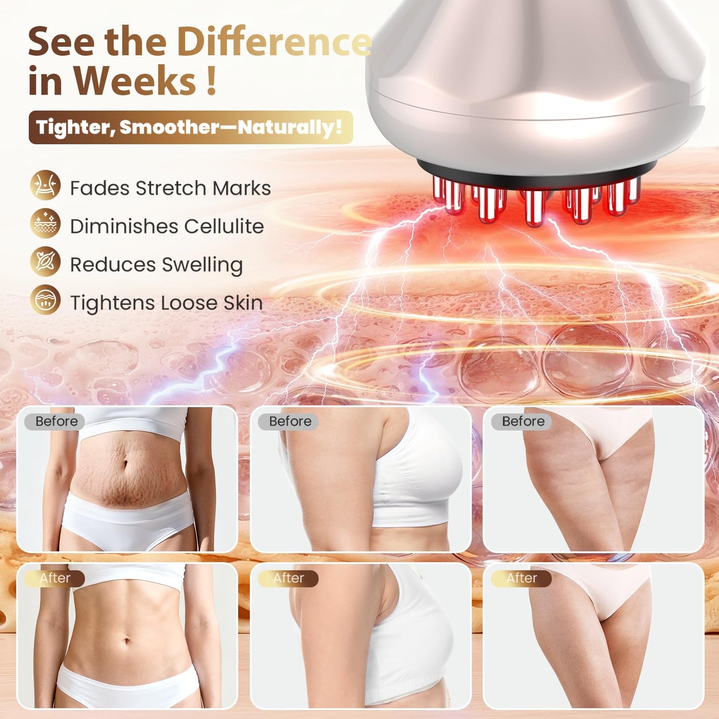 Lymphatic Drainage Massager, Anti Cellulite Massage Tool For Belly & Thigh Stretch Marks & Cellulite Reduction, Handheld Massage tools for Sciatica Nerve, shoulder, Hip, Muscle, Low Back Pain Relief nanagoo buy supplements Au