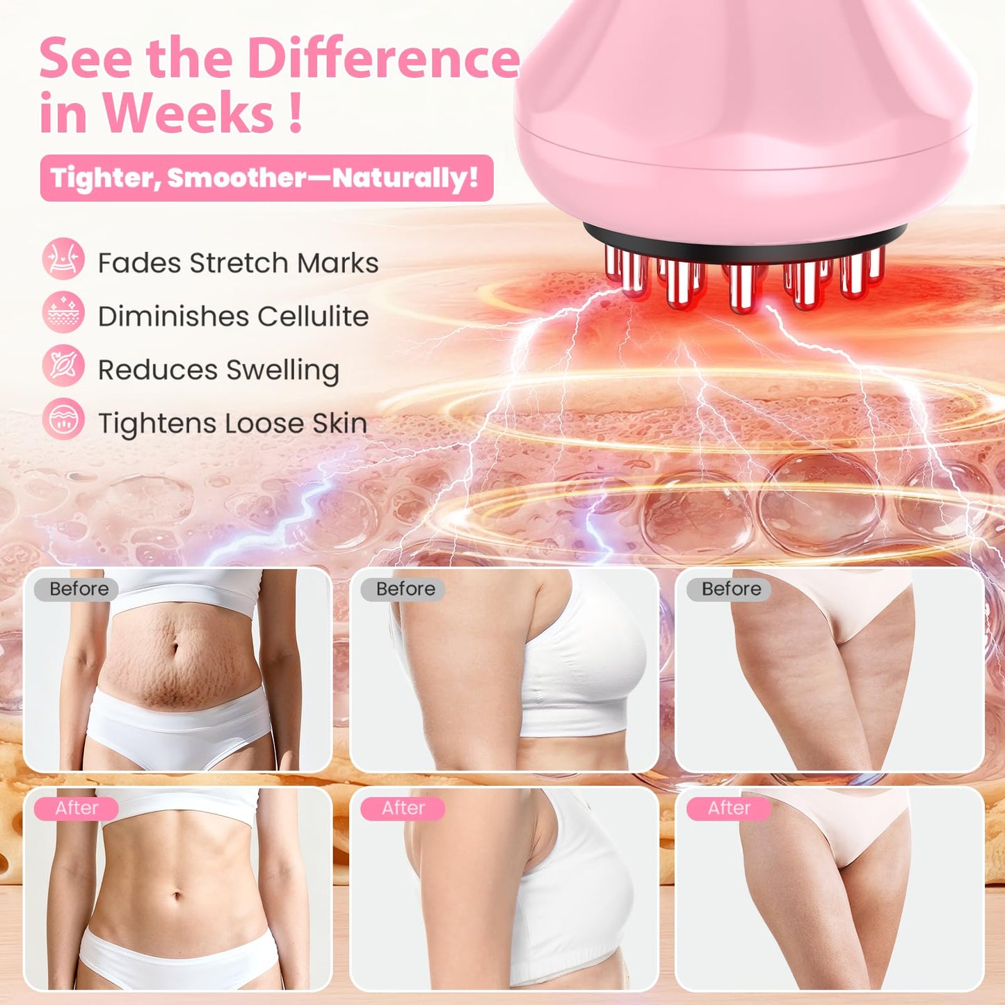 Lymphatic Drainage Massager, Anti Cellulite Massage Tool For Thigh & Belly Stretch Marks & Cellulite Reduction, Handheld Massage tools for Sciatica Nerve, Legs, Arms, Hip, Muscle, Low Back Pain Relief AIHEU buy supplements Au
