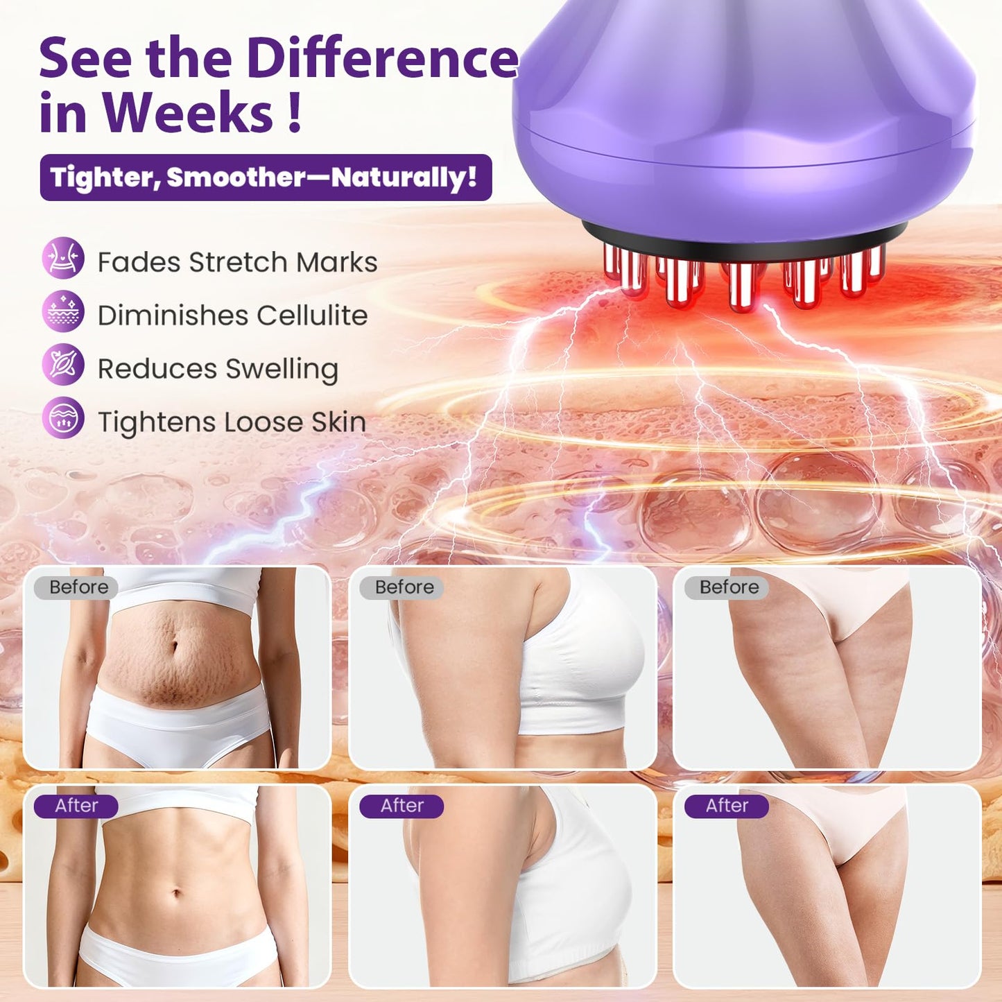 Lymphatic Drainage Massager, Anti Cellulite Massage Tool For Thigh & Belly Stretch Marks & Cellulite Reduction, Handheld Massage tools for Sciatica Nerve, Legs, Arms, Hip, Muscle, Low Back Pain Relief AIHEU buy supplements Au