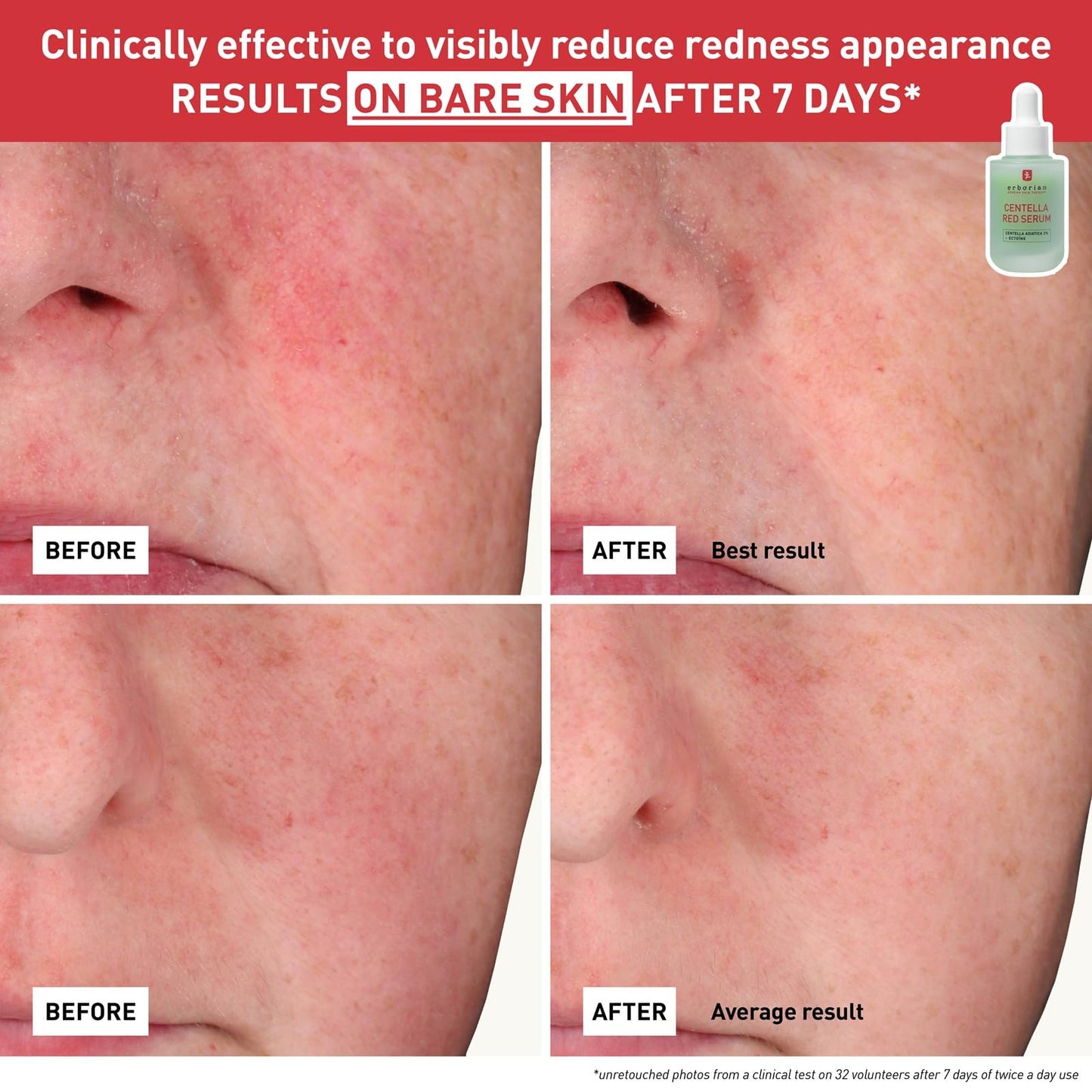 CENTELLA RED SERUM 10ML