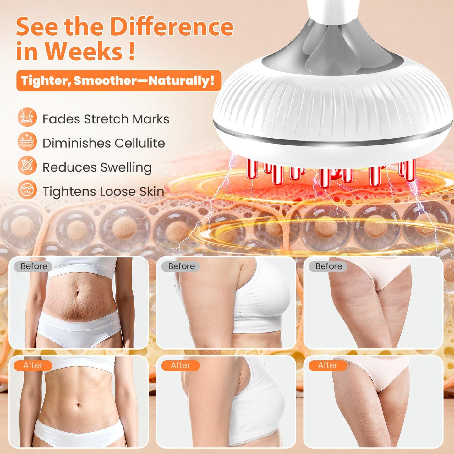 Choufaly Lymphatic Drainage Massager & Anti Cellulite Massage Tool, Helps Reduce Stretch Marks & Cellulite, for Legs, Arms & Belly, Body Sculpting Machine with Microcurrent & Light & Heat & Vibration Choufaly buy supplements Au
