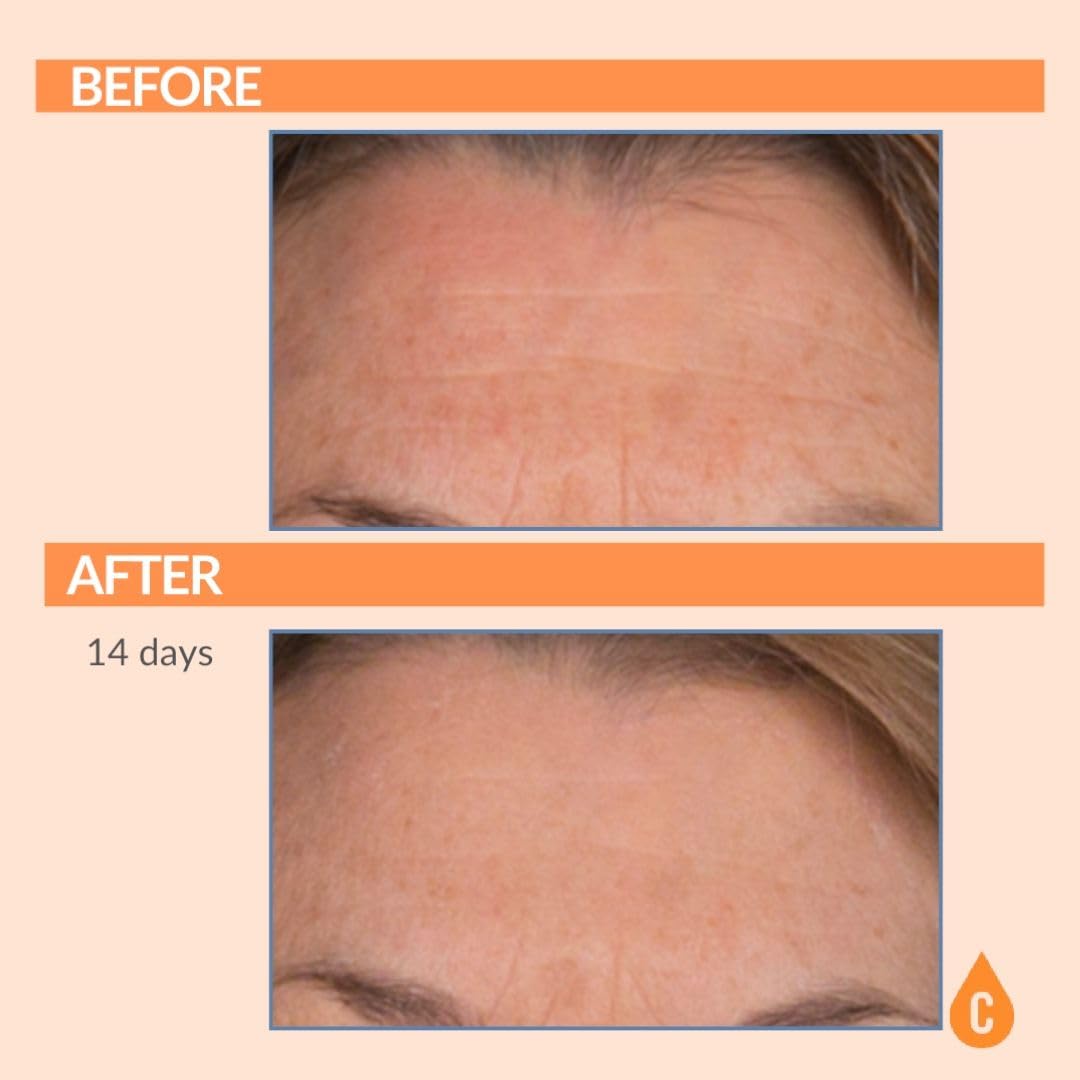 Serious Skincare Vitamin C Serum for Face, Anti-Aging Face Serum with Collagen, Vitamin E, Hydrating Skin Care for Brightening, Improve Appearance of Dark Spots