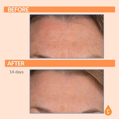 Serious Skincare Vitamin C Serum for Face, Anti-Aging Face Serum with Collagen, Vitamin E, Hydrating Skin Care for Brightening, Improve Appearance of Dark Spots