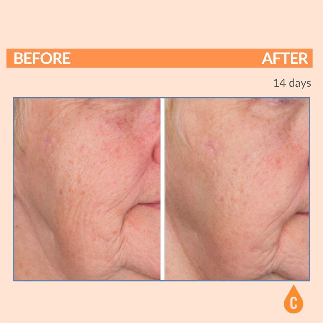 Serious Skincare Vitamin C Serum for Face, Anti-Aging Face Serum with Collagen, Vitamin E, Hydrating Skin Care for Brightening, Improve Appearance of Dark Spots