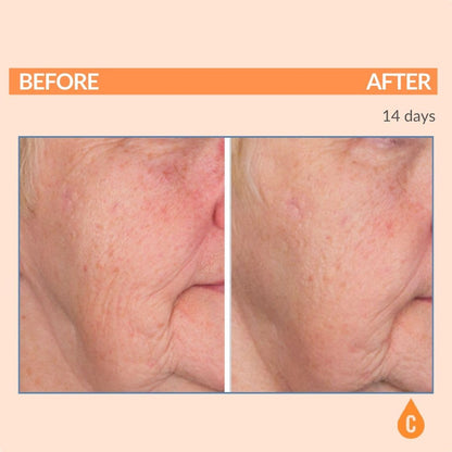 Serious Skincare Vitamin C Serum for Face, Anti-Aging Face Serum with Collagen, Vitamin E, Hydrating Skin Care for Brightening, Improve Appearance of Dark Spots