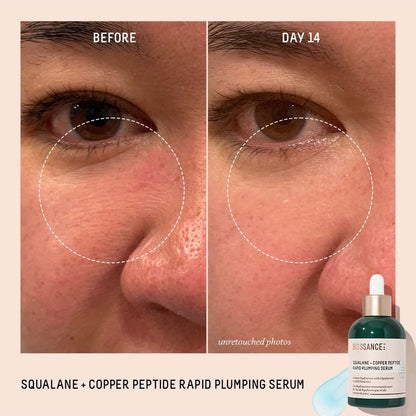 Biossance Squalane + Copper Peptide Rapid Plumping Serum - Face Serum for All Skin Types - Visibly Plumping + Firming Skin, Fine Lines + Wrinkles,