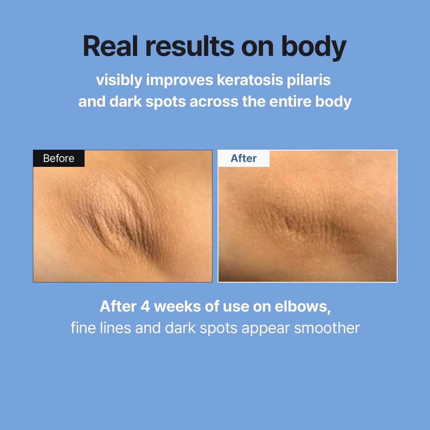 MEDITHERAPY Retinal Skin Booster Serum | Retinaldehyde, Niacinamide Anti-Aging Serum - K-Beauty Facial Serum for Fine Lines, Firming & Radiance