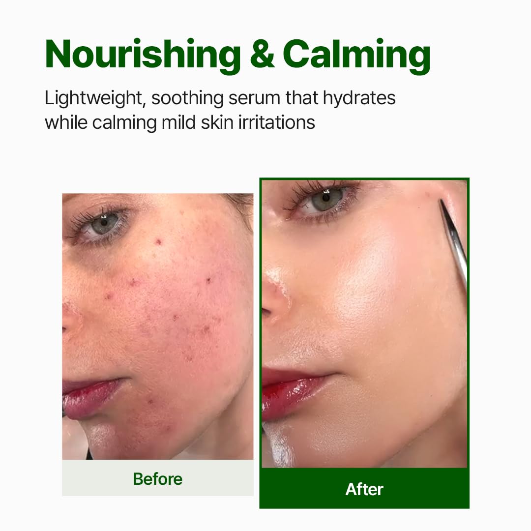 NACIFIC Cica PDRN Centella Serum (Centella Ampoule) 1.69 fl oz / 50ml, Korean Serum for Sensitive Skin, Calming & Hydrating