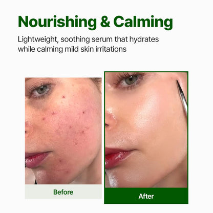 NACIFIC Cica PDRN Centella Serum (Centella Ampoule) 1.69 fl oz / 50ml, Korean Serum for Sensitive Skin, Calming & Hydrating