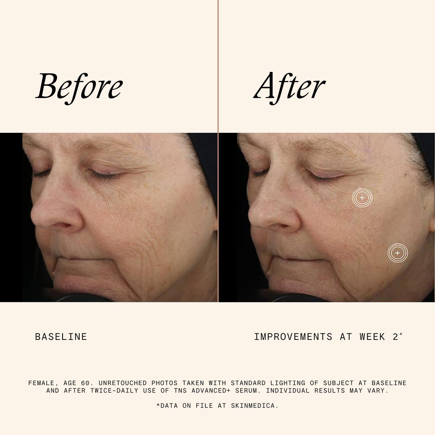 SkinMedica TNS Advanced+ Face Serum - Multi Peptide Serum to Help Improve the Appearance of Wrinkles, Fine Lines, Skin Tone & Texture (1 oz)
