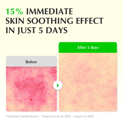 EQQUALBERRY Aloe PDRN Calming Smoothie Serum – Soothing Korean Skin Care for Sensitive Skin, Cica & Aloe for Repair, Hydrating & Radiant Glow
