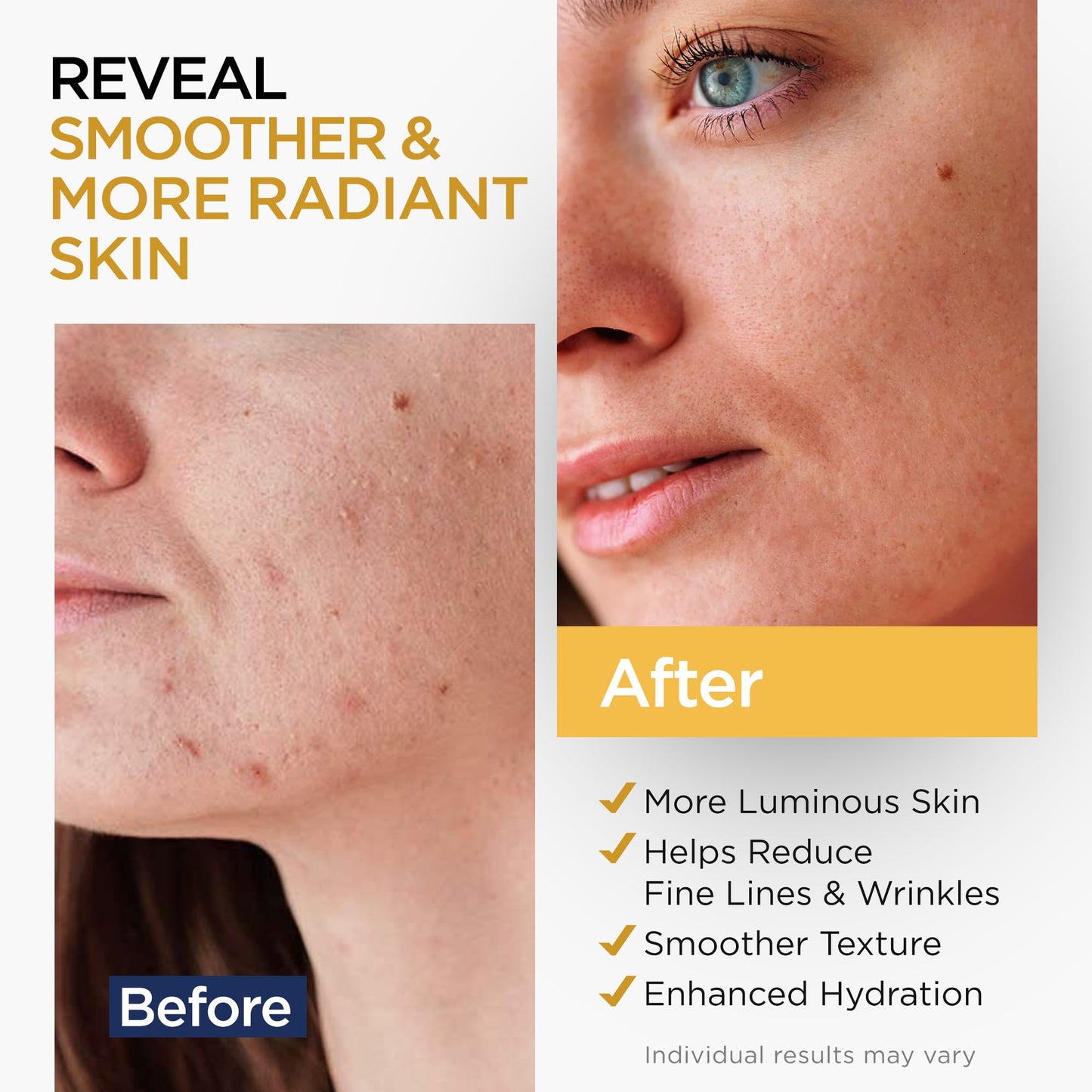 Vitamin C Serum for Face with Stem Cells Hyaluronic Acid Aloe Vera Vitamin E Anti-Aging Face Serum Supports Skin Health & Even Tone