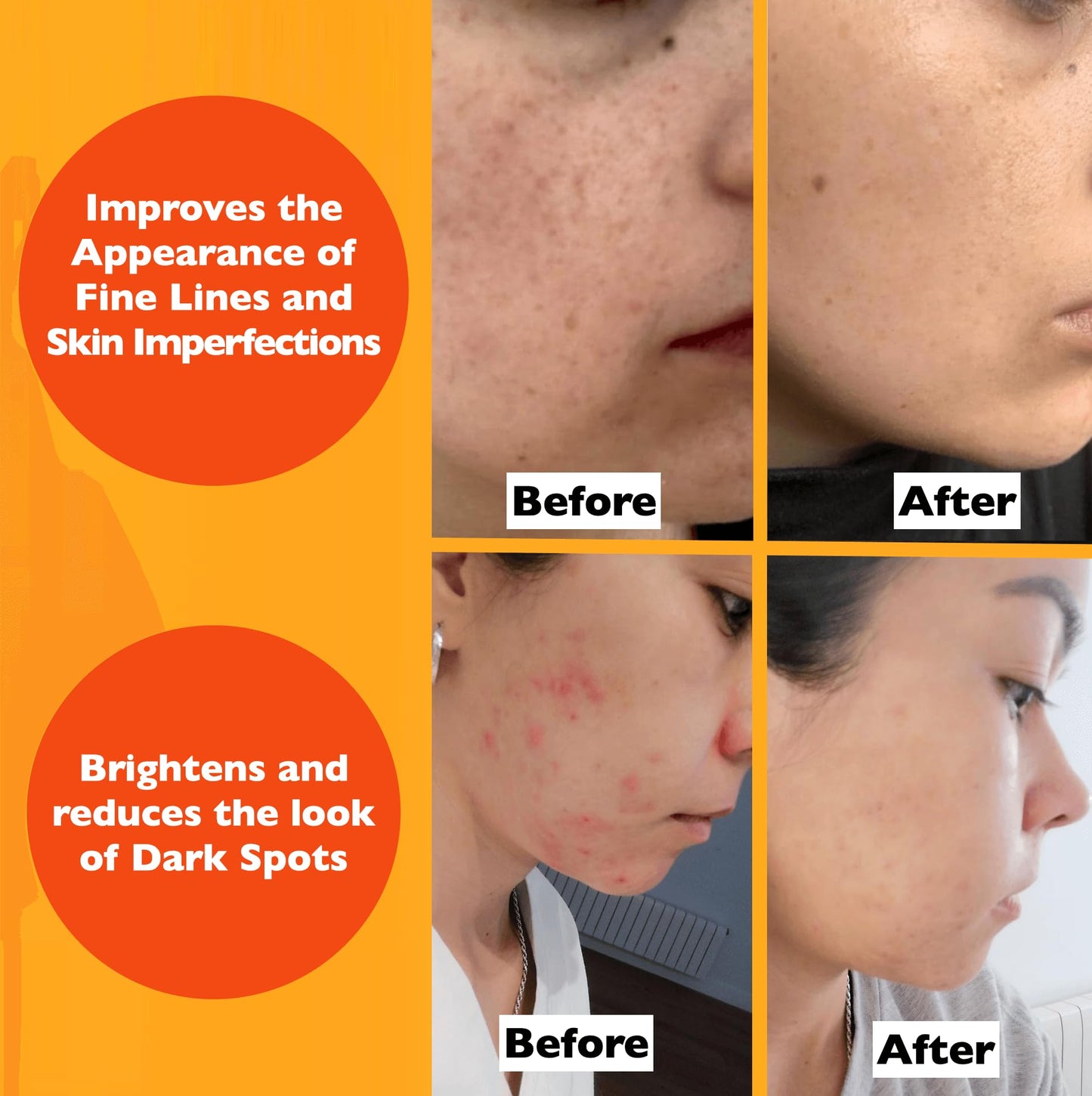 Vitamin C Serum For Face – Anti Aging Face Serum with Vitamin C, Hyaluronic Acid, Vitamin E. Brightening Formula. Improve Appearance of Dark Spots,