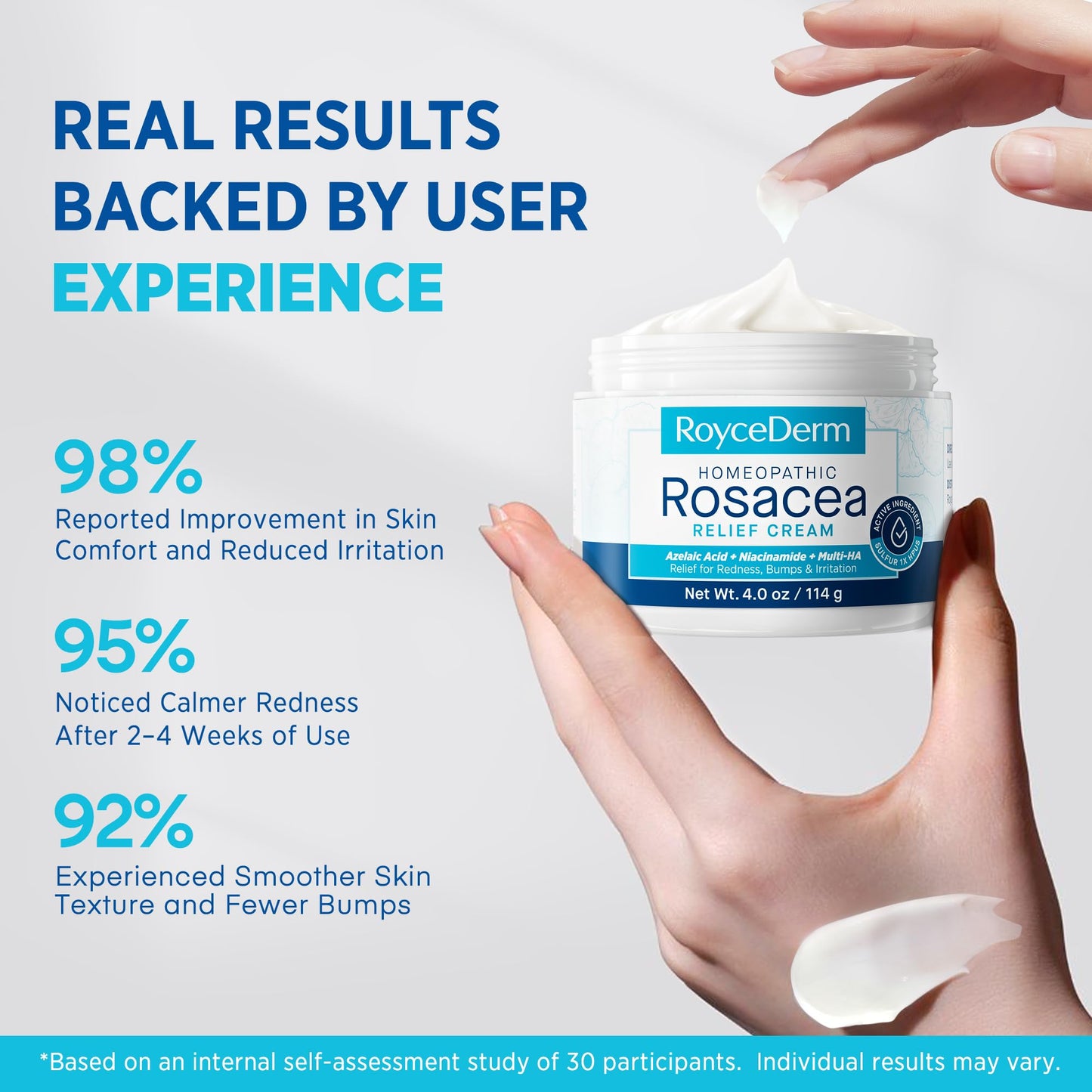 Roycederm Rosacea Treatment for Face with Azelaic Acid – Redness Relief & Corrector – Sensitive Skin Moisturizer for Redness, Bumps & Irritation