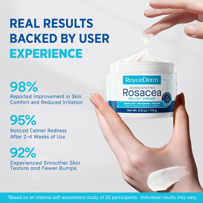 Roycederm Rosacea Treatment for Face with Azelaic Acid – Redness Relief & Corrector – Sensitive Skin Moisturizer for Redness, Bumps & Irritation