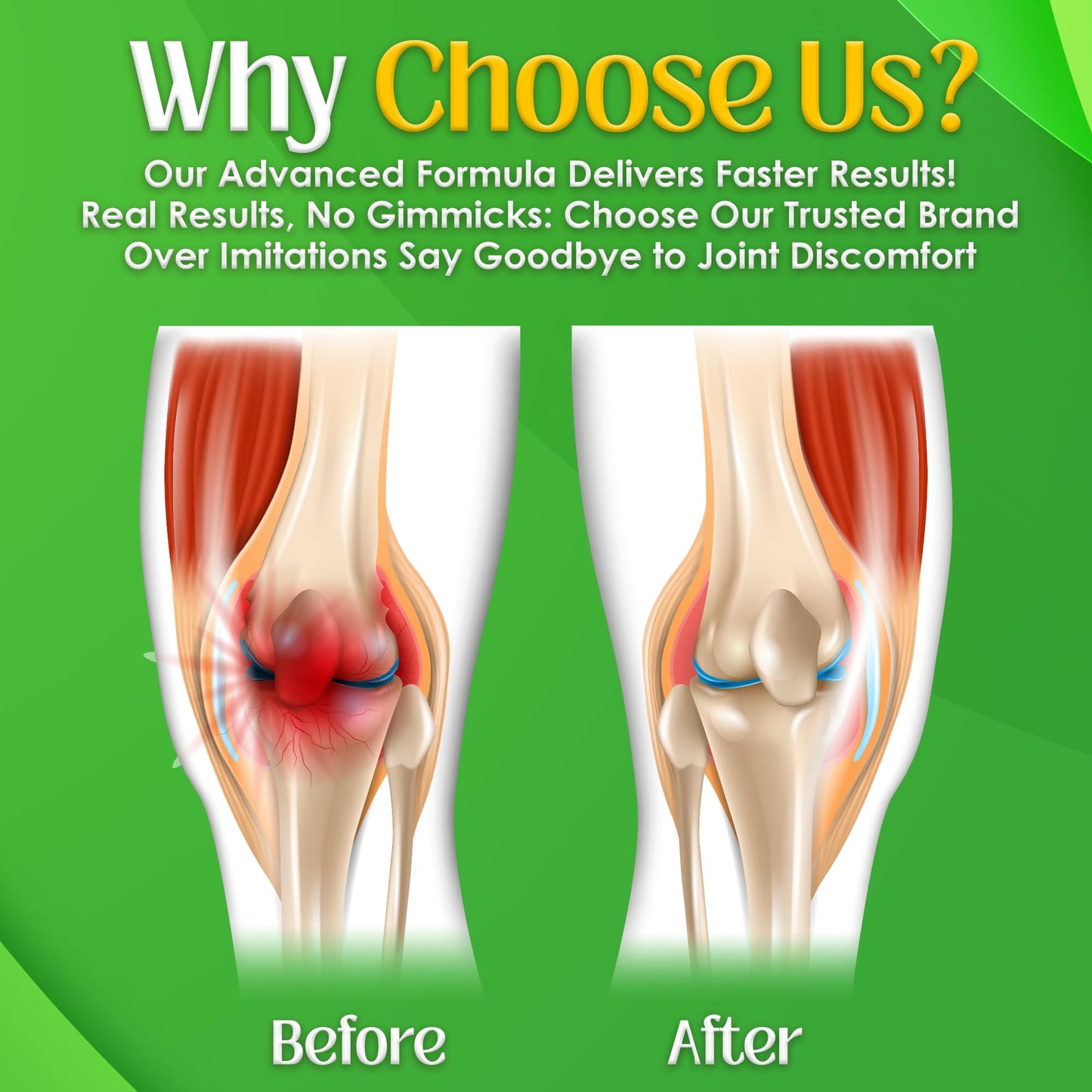 NutriGout Uric Acid Cleanse Supplement w/Turmeric, Celery Seed, Bromelain, Milk Thistle, Dandelion and Chanca Piedra,