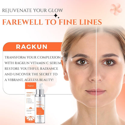 Ragkun 20% Vitamin C Serum, Retinol Serum for Face, Dark Spot Remover for Face, CE Ferulic Acid, Hyaluronic Acid, Hydrate & Plump Skin Care