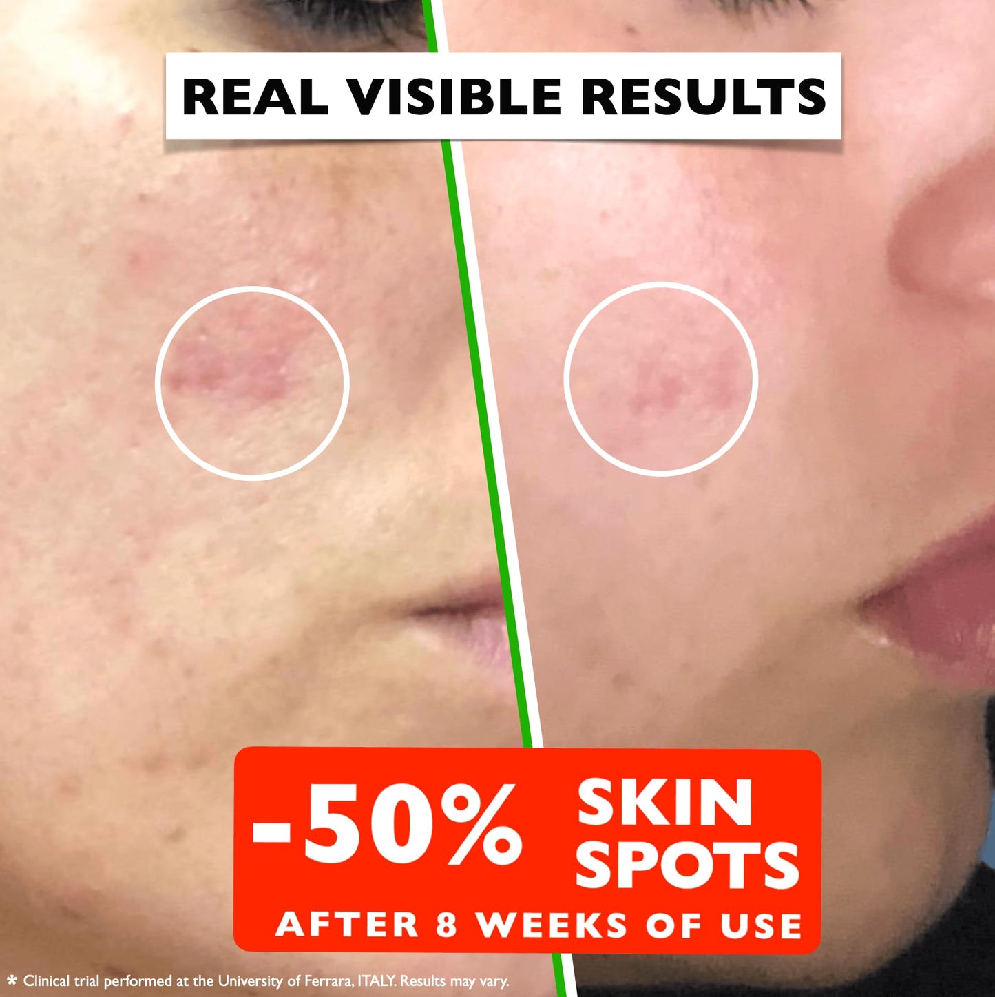 Vitamin C Serum For Face – Anti Aging Face Serum with Vitamin C, Hyaluronic Acid, Vitamin E. Brightening Formula. Improve Appearance of Dark Spots,