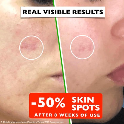 Vitamin C Serum For Face – Anti Aging Face Serum with Vitamin C, Hyaluronic Acid, Vitamin E. Brightening Formula. Improve Appearance of Dark Spots,