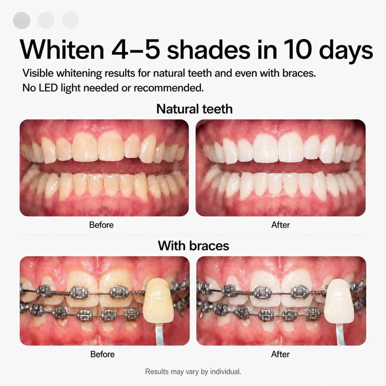 Opalescence Go 15- Prefilled Teeth Whitening Trays Kit - 15% Hydrogen Peroxide - (10 Treatments) Dentist Recomended - Made by Ultradent Products