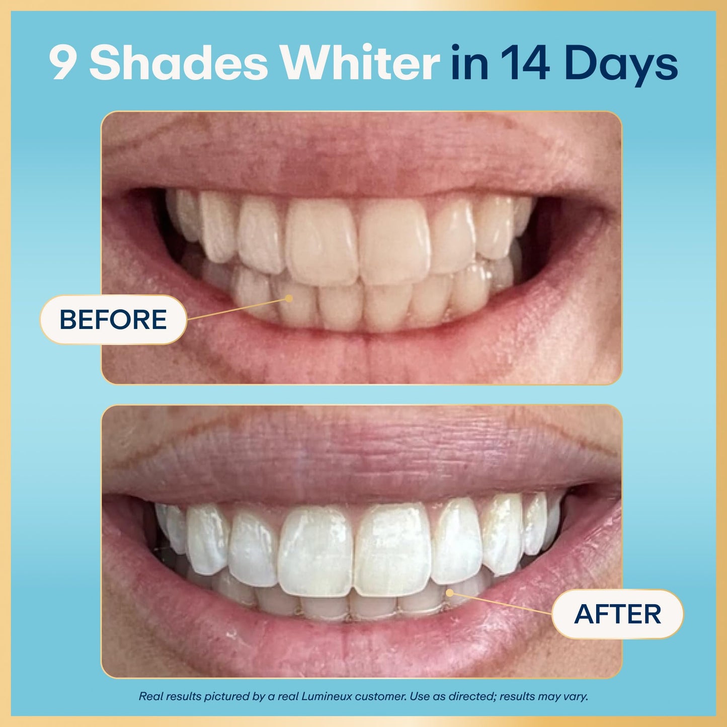 Lumineux Teeth Whitening Strips Kit - 9 Treatments (1 Month) - Peroxide Free - Enamel Safe for Whiter Teeth - Whitening Without The Sensitivity