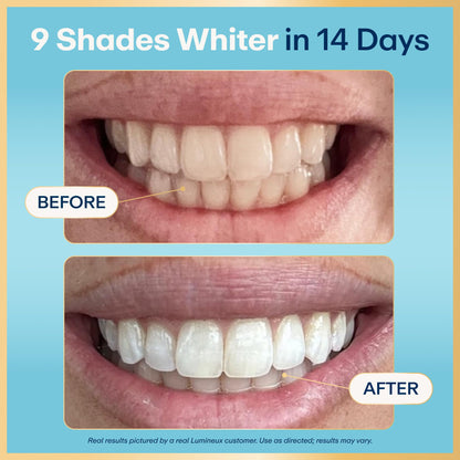 Lumineux Teeth Whitening Strips Kit - 9 Treatments (1 Month) - Peroxide Free - Enamel Safe for Whiter Teeth - Whitening Without The Sensitivity