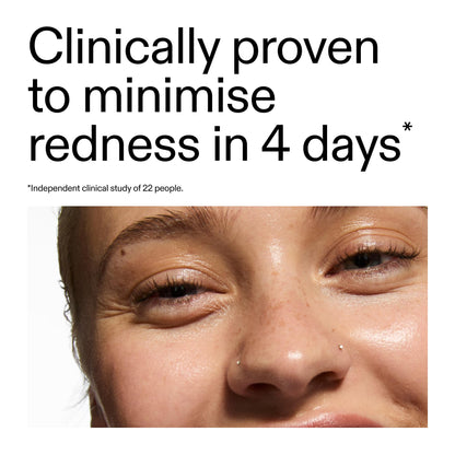 The INKEY List SuperSolutions Azelaic Acid 10% Serum, Fast-Absorbing Formula Helps Reduce Appearance of Redness and Soothes Skin,