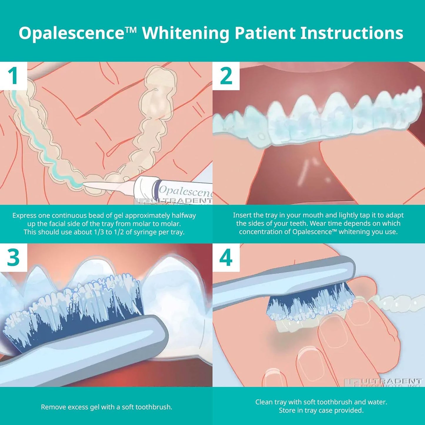 Opalescence 35% CP Mint - Gel Syringes Teeth Whitening - Refill Kit - Carbamide Peroxide Gel. Made by Ultradent