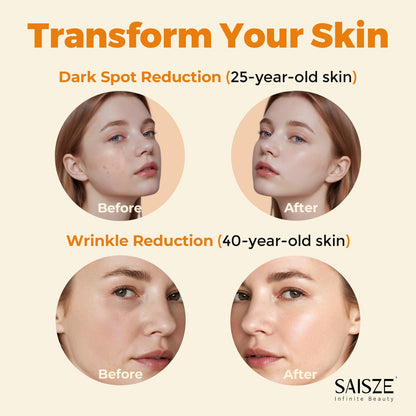 SAISZE Vitamin C Serum for Face, Facial Serum for Dark Spot, Skin Care Gifts for Women, Mothers Day gifts, Anti Aging with Vitamin C, Hyaluronic Acid, 60ml