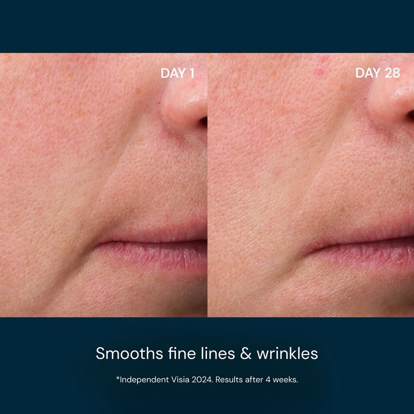 ELEMIS Pro-Collagen Future Restore Serum 30ml, Advanced Anti-Aging Serum To Firm, Restore & Smooth Skin