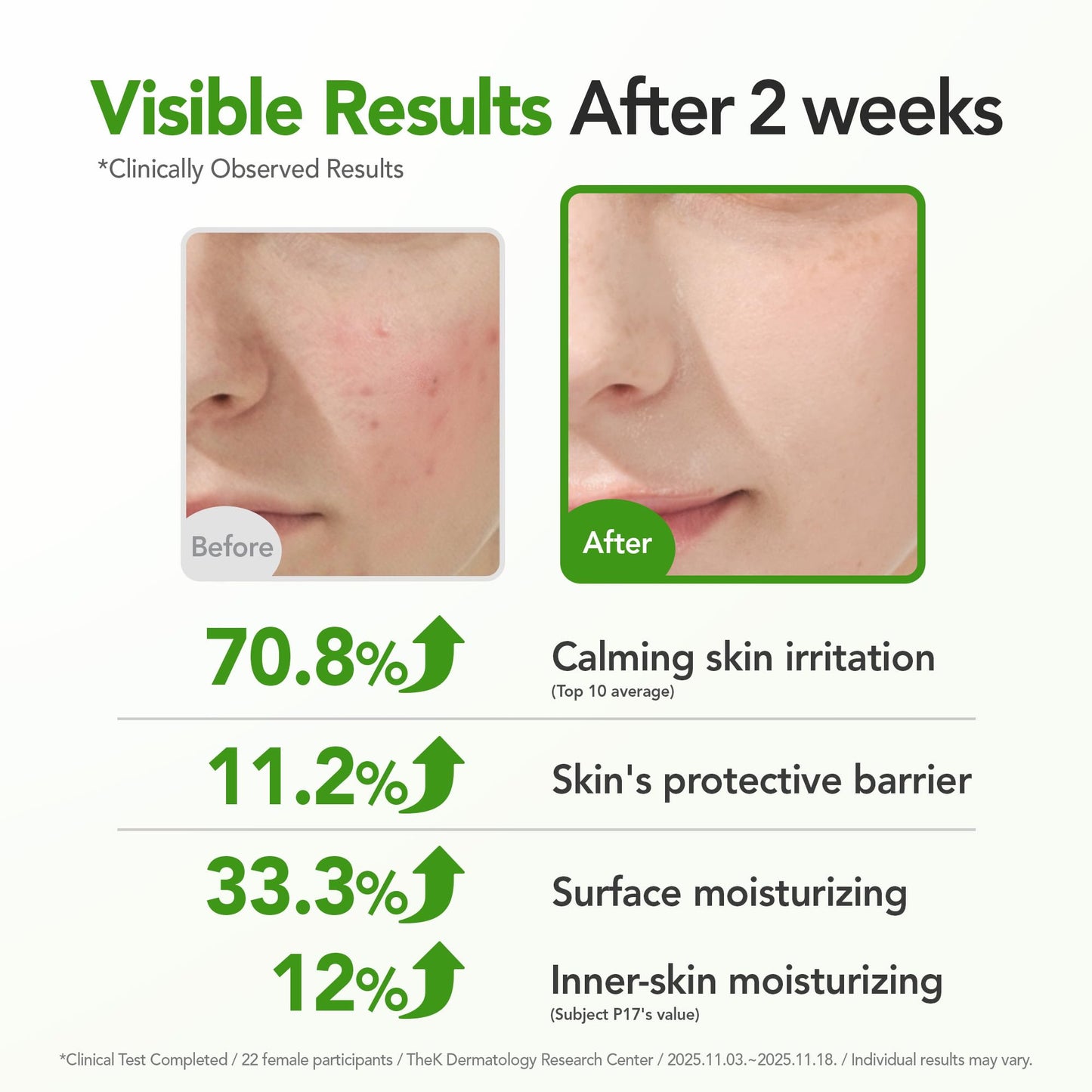 BALOOM Centella Asiatica Calming Ampoule with TECA & Niacinamide - Korean Cica Serum for Sensitive Skin - Soothing Redness Relief,
