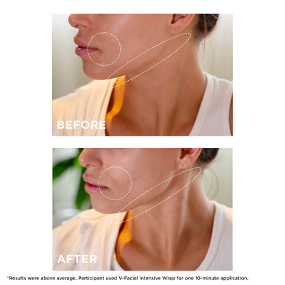 Clarins V-Facial Intensive Wrap Face Mask | Award-Winning Facial Contouring Mask | Visibly Reduces Puffiness and Swelling Caused by Stress,Heat and Hormonal Changes