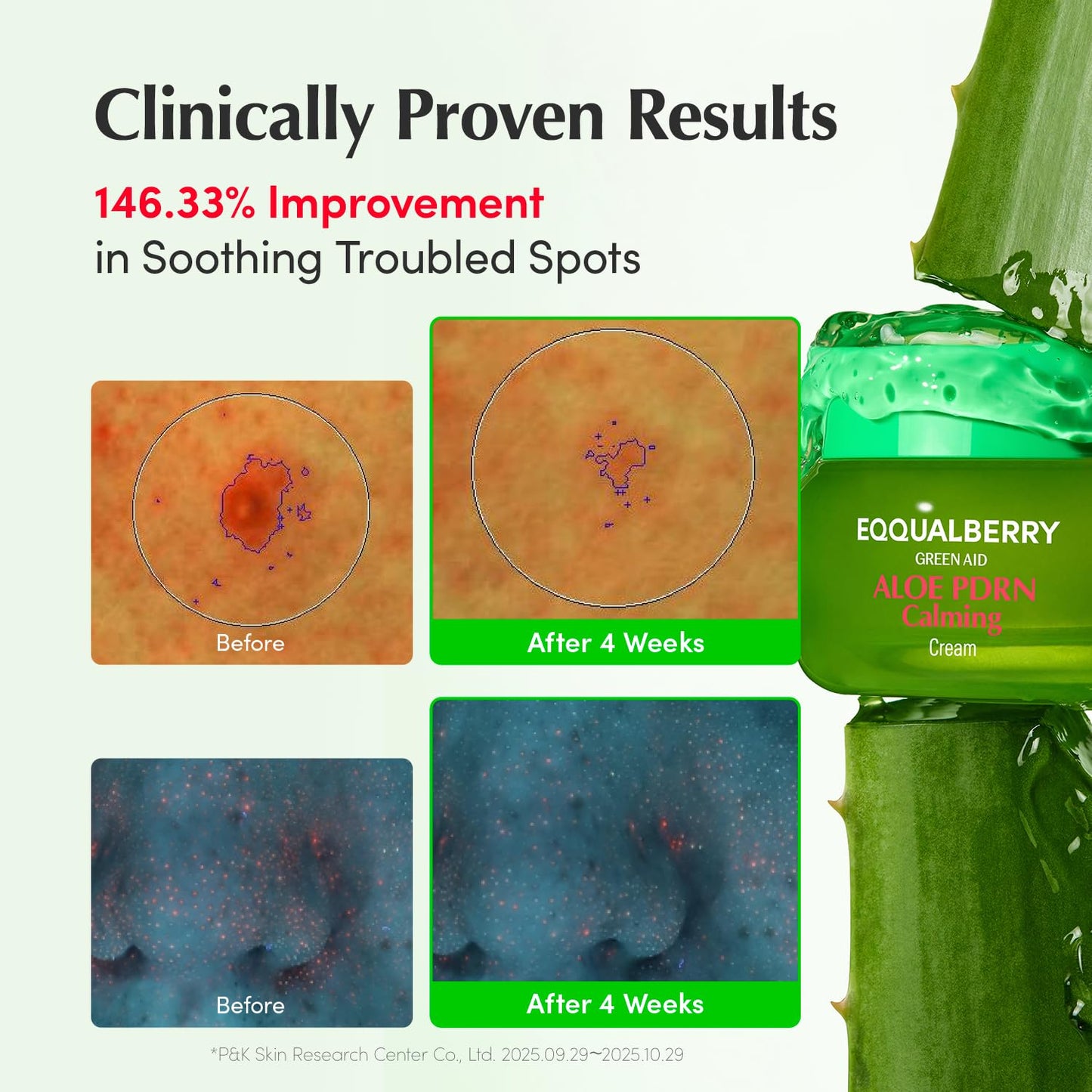 EQQUALBERRY ALOE PDRN Calming Cream | 7% Aloe PDRN & 10% Aloe Vera Water + 5-Cica | Cooling Gel Moisturizer for Oily Skin, Barrier Repair & Blemish Marks
