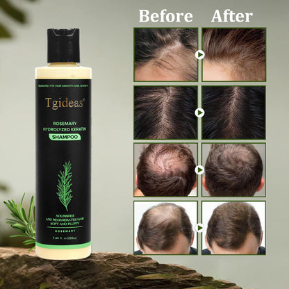Tgideas Organic Rosemary Hair Growth Shampoo for Women and Men-Natural Thickening & Strengthening Shampoo with Hydrolyzed Keratin