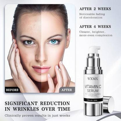 Super Vitamin C Serum for Face: All-in-One Hydrating Anti-Aging Formula by Vitamin C, Hyaluronic Acid, Caffeine-Firming, Lifting, Targets Dark Spots,