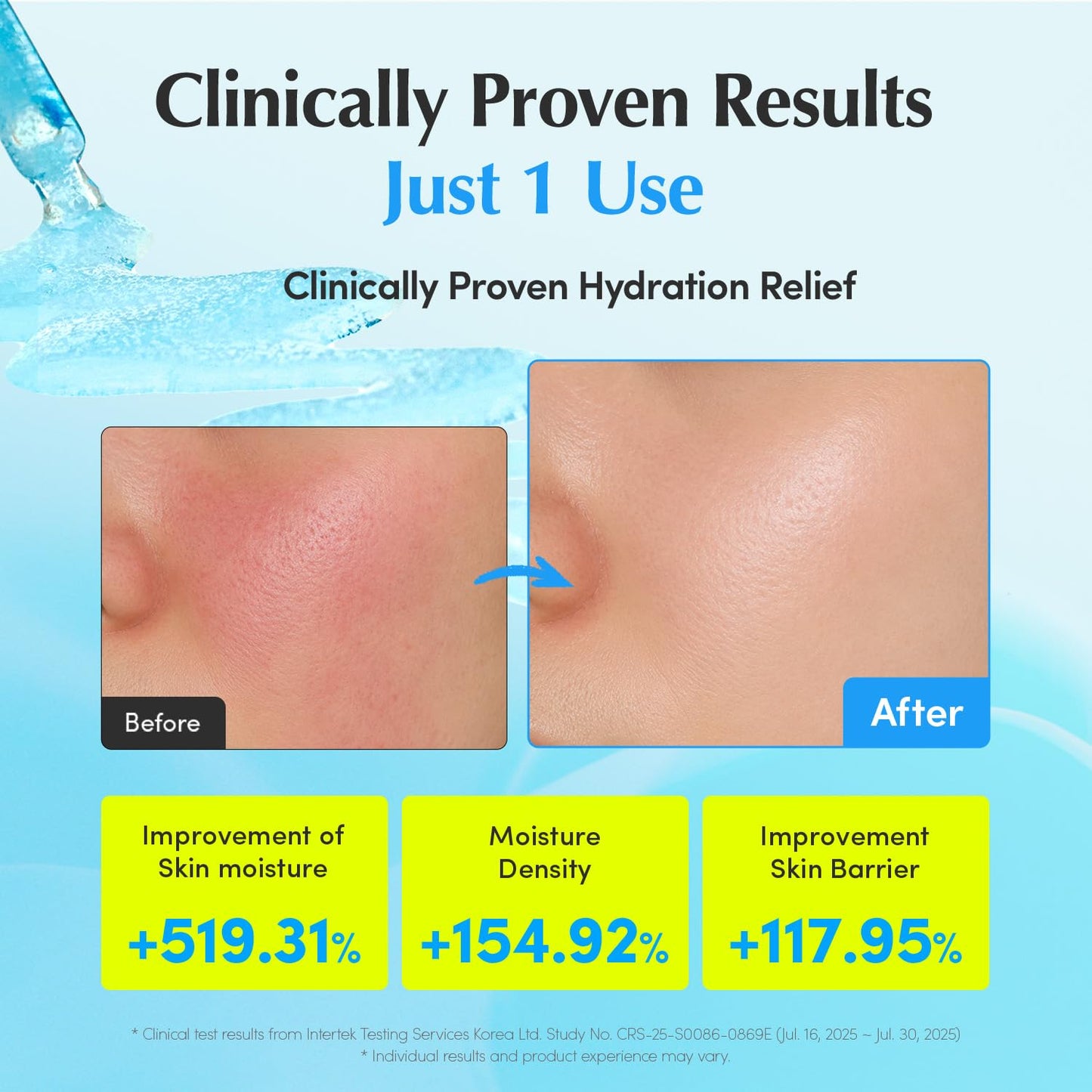 EQQUALBERRY Hyaltoin Flooding Smoothie Serum | 5% Hyaluronic Acid Serum for Face & Redness Relief | Deep Hydrating Cooling Care with 5 Ceramides