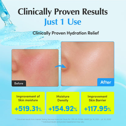 EQQUALBERRY Hyaltoin Flooding Smoothie Serum | 5% Hyaluronic Acid Serum for Face & Redness Relief | Deep Hydrating Cooling Care with 5 Ceramides