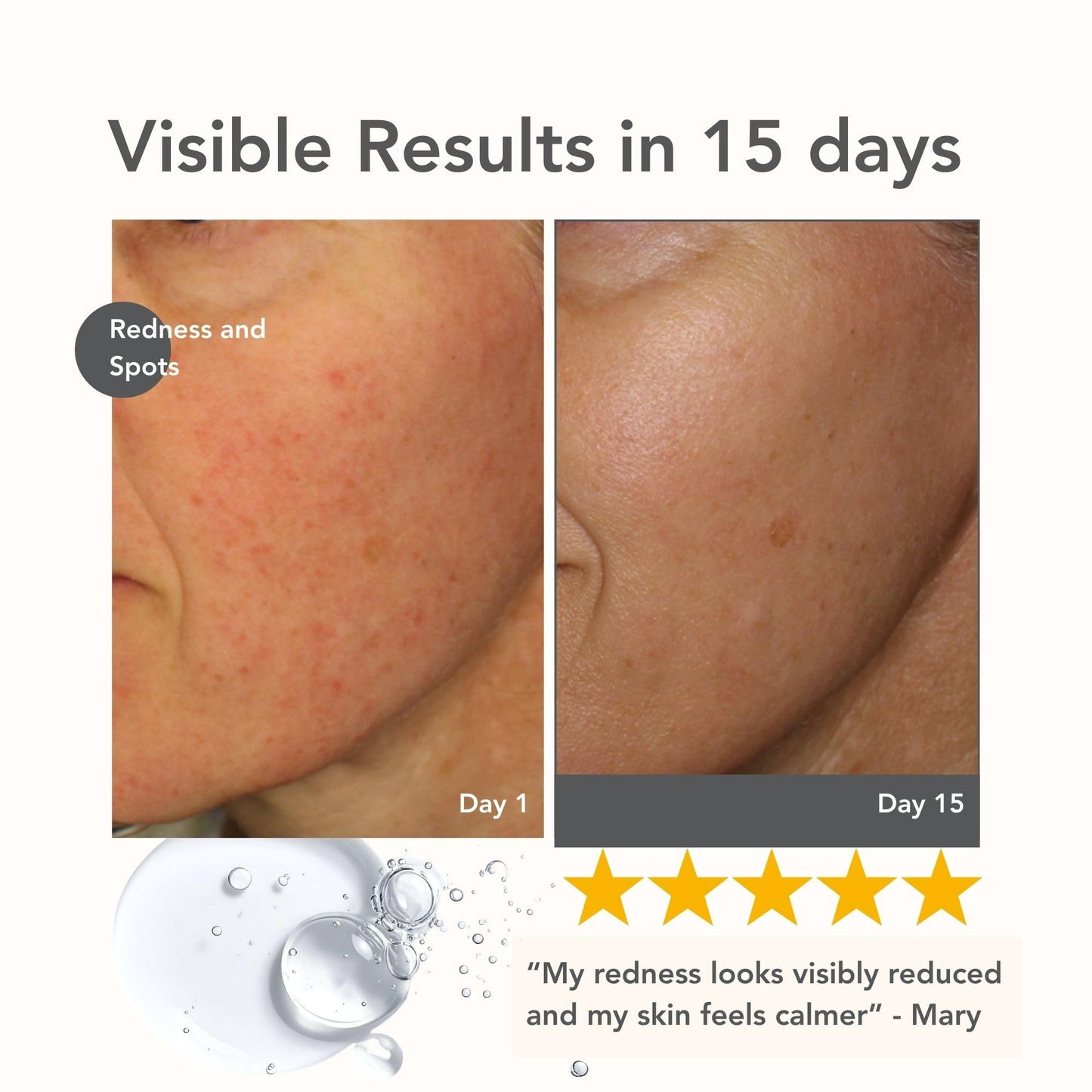 Riversol Rosacea Treatment for Face | Anti-Redness Serum for Sensitive Skin | Calming Redness Relief | Vitamin C & E | Anti-Aging Formula | Fragrance Free