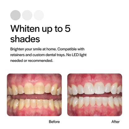 Opalescence 35% CP Mint - Gel Syringes Teeth Whitening - Refill Kit - Carbamide Peroxide Gel. Made by Ultradent