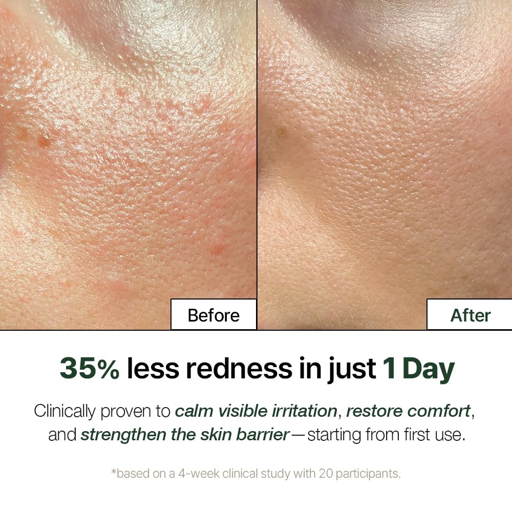 NATURAL DERMA PROJECT NDP Cica Cream - Gel Face Moisturizer for Sunburn Relief, lightweight Korean Moisturizer for Sensitive Skin, Centella Asiatica,