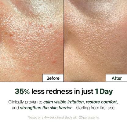 NATURAL DERMA PROJECT NDP Cica Cream - Gel Face Moisturizer for Sunburn Relief, lightweight Korean Moisturizer for Sensitive Skin, Centella Asiatica,