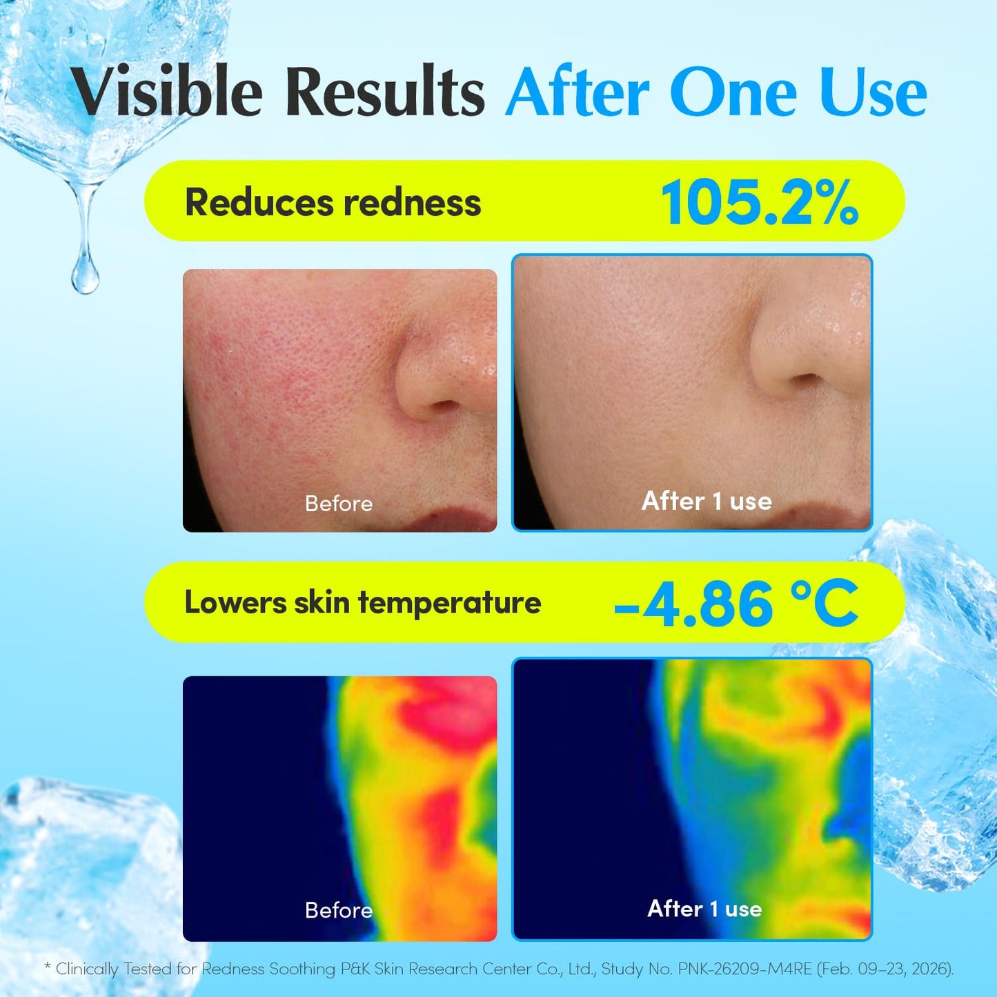 EQQUALBERRY HYALTOIN Flooding Cream | 5% Hyaluronic Acid & Ectoin, 10% Glacier Water | Quick Cooling Gel Moisturizer: Hydration, Barrier Repair & Redness Relief