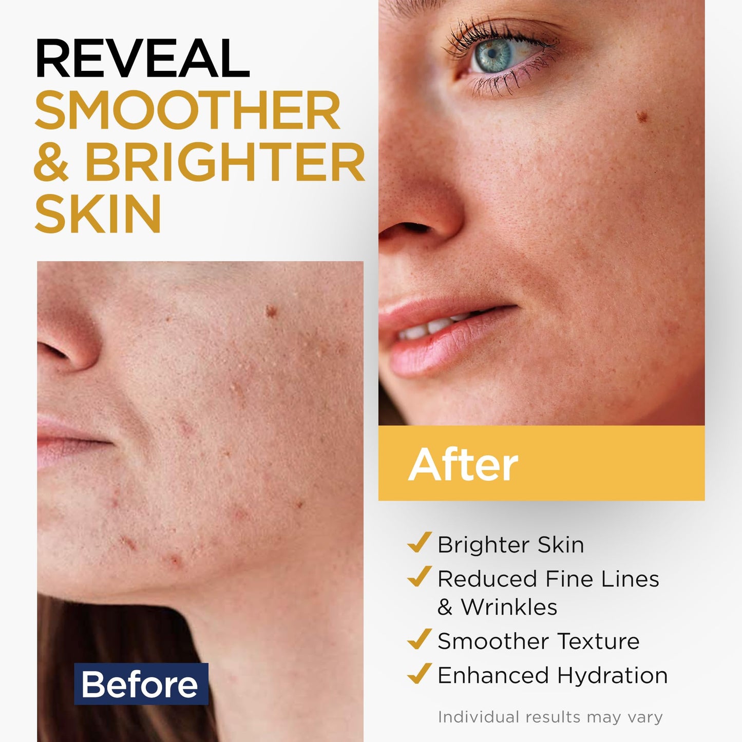 Vitamin C Serum for Face with Stem Cells Hyaluronic Acid Vitamin E Aloe Vera Anti-Aging Face Serum Supports Skin Health
