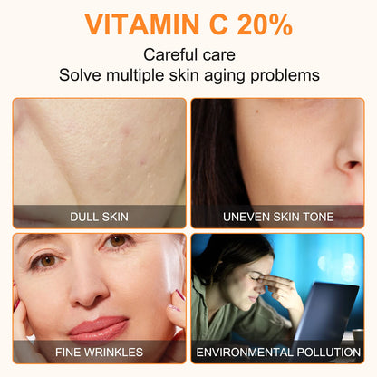 Premium 20% Vitamin C Serum For Face with Hyaluronic Acid, Retinol & Amino Acids - Boost Skin Collagen,Hydrate & Plump Skin,