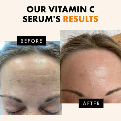 Eclat Skincare Vitamin C Serum - Skin Care for Dark Spots, Vitamin C Serum for Face with Hyaluronic Acid, Ferulic Acid, & Vit E