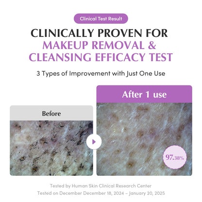EQQUALBERRY Purple Rice Pore Smoothing Cleansing Oil – Deep Cleansing for Pores & Blackheads | Korean Oil Cleanser for Face & Makeup Remover