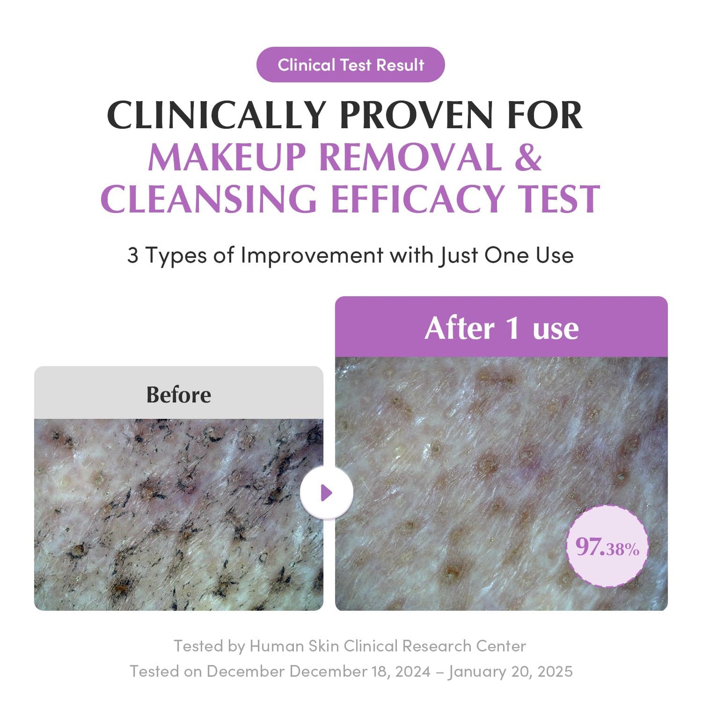 EQQUALBERRY Double Cleanser Duo for Facial Cleansing: Purple Rice Pore Cleansing Oil & Pack Cleanser – Removes Makeup, Blackheads & Impurities