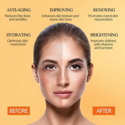 SHVYOG Turmeric Vitamin C Clay Mask with Kaolin Clay for Dull & Blemish-Prone Skin, Deep Cleansing Facial Mask, Face Masks Skincare for Controlling Oil