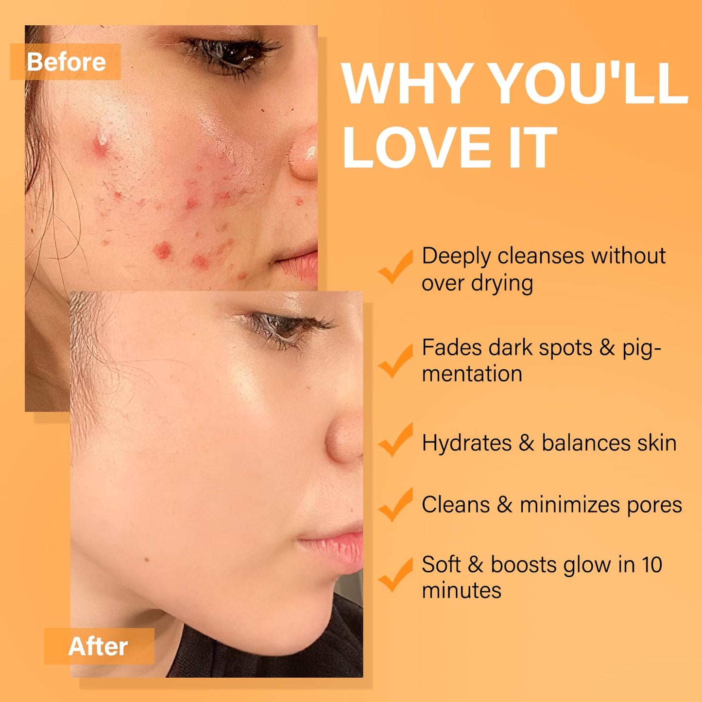 Facial Clay Mask Set - Vitamin C Turmeric Face Mask, Dead Sea Mud & Salicylic Acid (BHA) Mask for Pore Cleansing, Brightening, Blackheads & Dark Spots, Face Masks Skincare