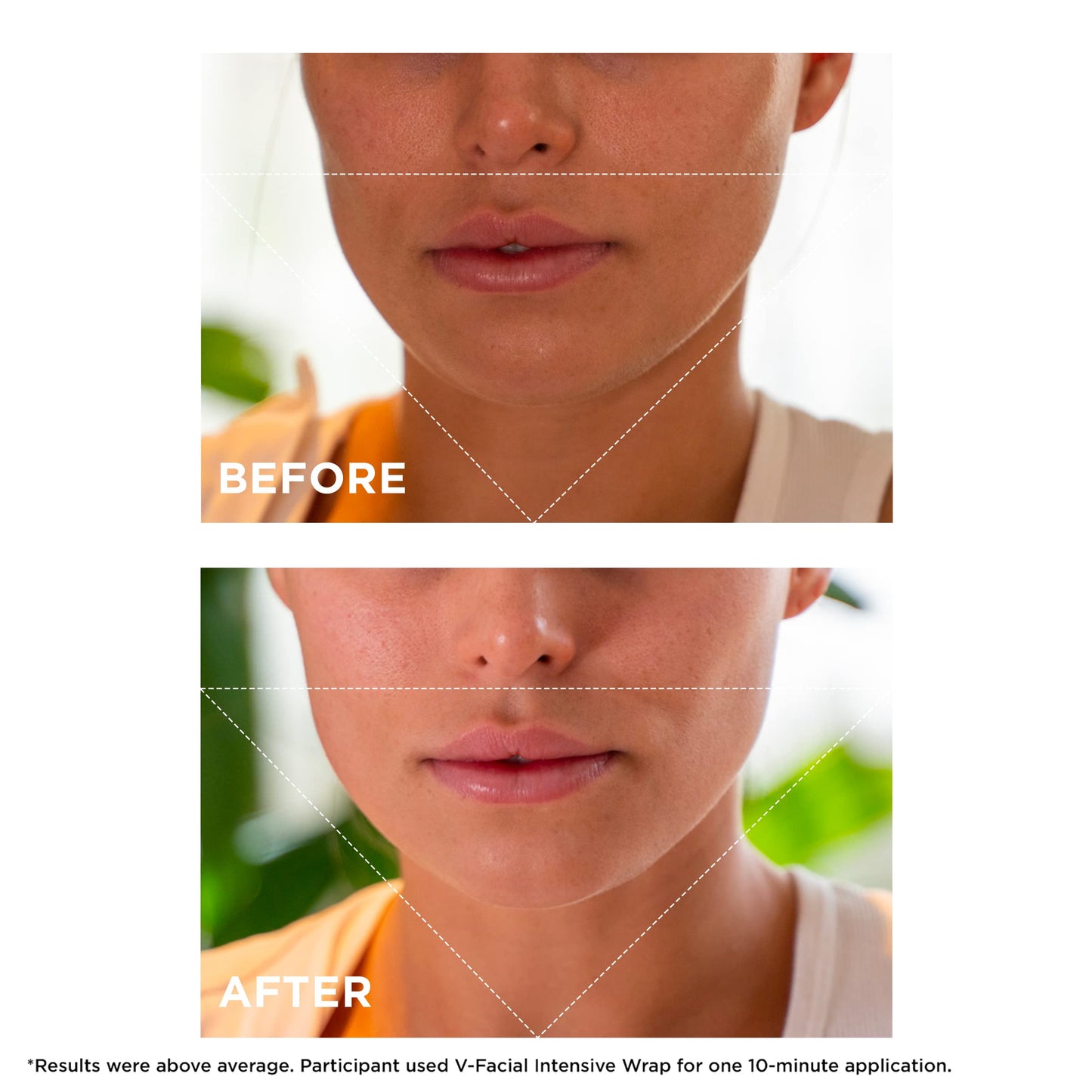 Clarins V-Facial Intensive Wrap Face Mask | Award-Winning Facial Contouring Mask | Visibly Reduces Puffiness and Swelling Caused by Stress,Heat and Hormonal Changes